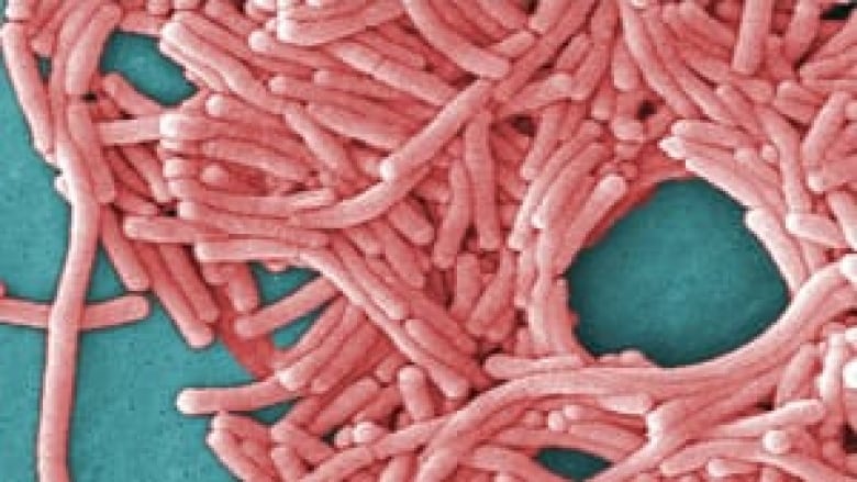 Legionella bacteria