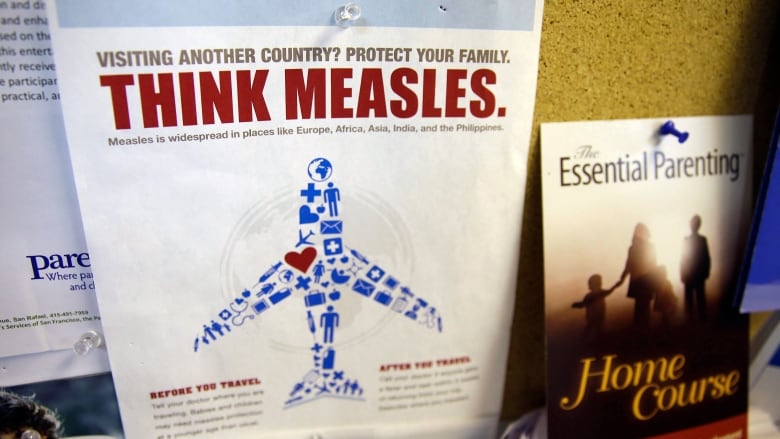  A flyer educating parents about measles showing a diagram of a plan with red spots is displayed on a bulletin board in California.