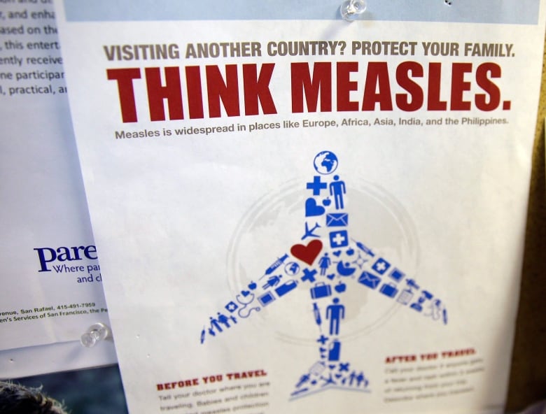  A flyer educating parents about measles showing a diagram of a plan with red spots is displayed on a bulletin board in California.