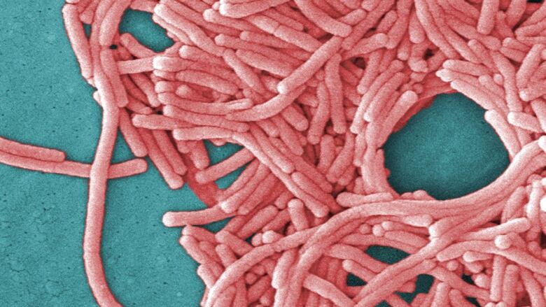 An up-closed electron micrograph image of a pink-coloured bacteria on a teal blue background