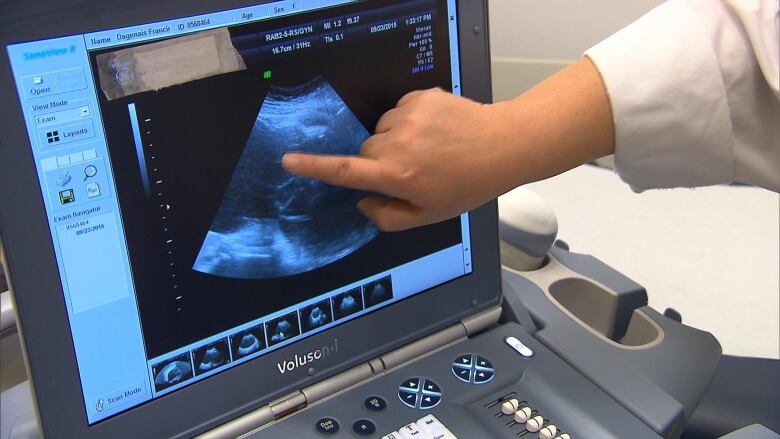 A hand pointing to an ultrasound screen.