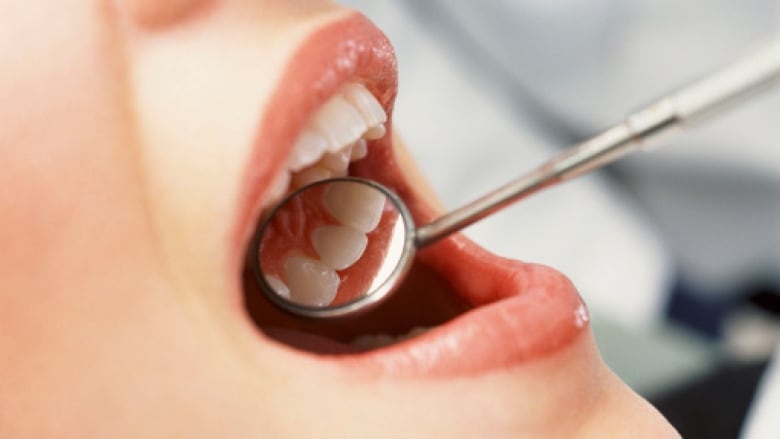 An image of a dentist's explorer tool reflecting in a patient's mouth.