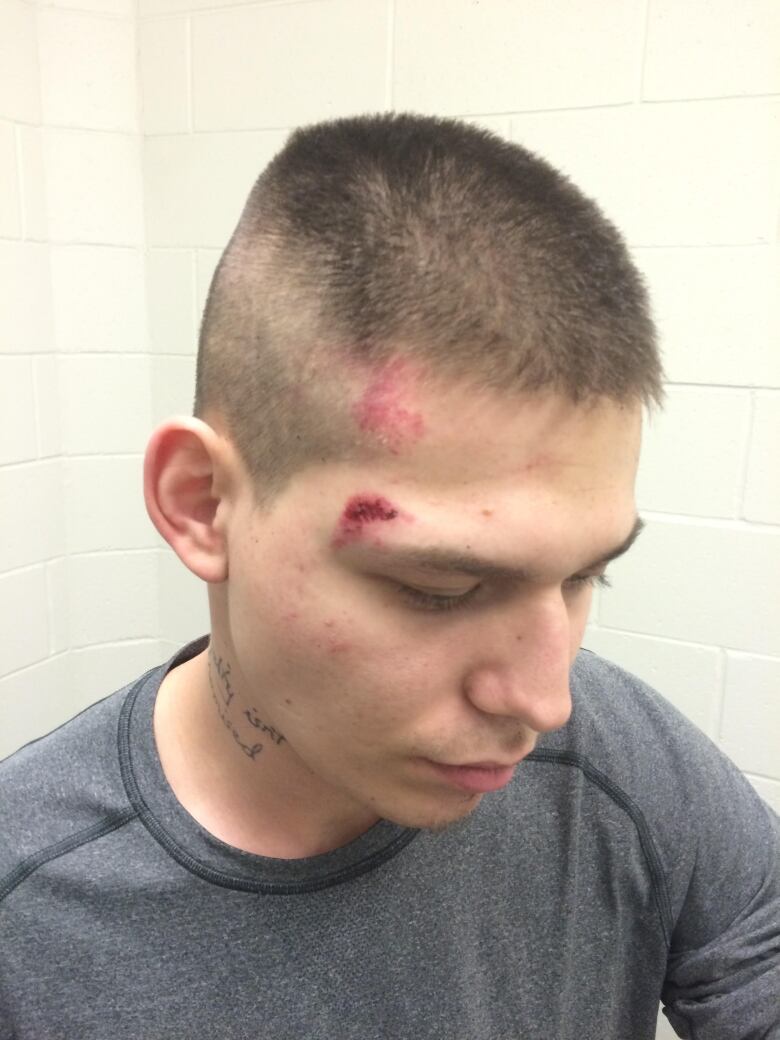 A young man with short hair looks to the side. A cut is visible above his eye and a red patch on his forehead. 