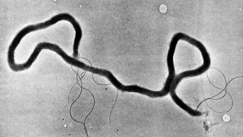 In this May 23, 1944 file photo, the organism treponema pallidum, which causes syphilis, is seen through an electron microscope.  