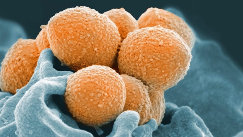 An electron microscope image shows group A streptococcus during phagocytic interaction with a human neutrophil.