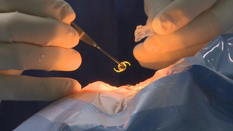 A closeup on the gloved hands of a surgeon performing cataract surgery.