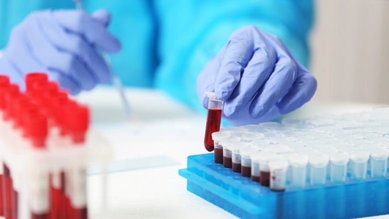 A worker handles vials of blood.