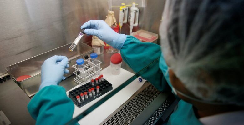 A lab technician analyzes blood samples.