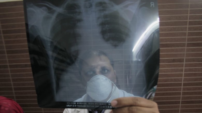 A doctor looks at an X-ray.