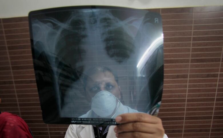 A doctor looks at an X-ray.