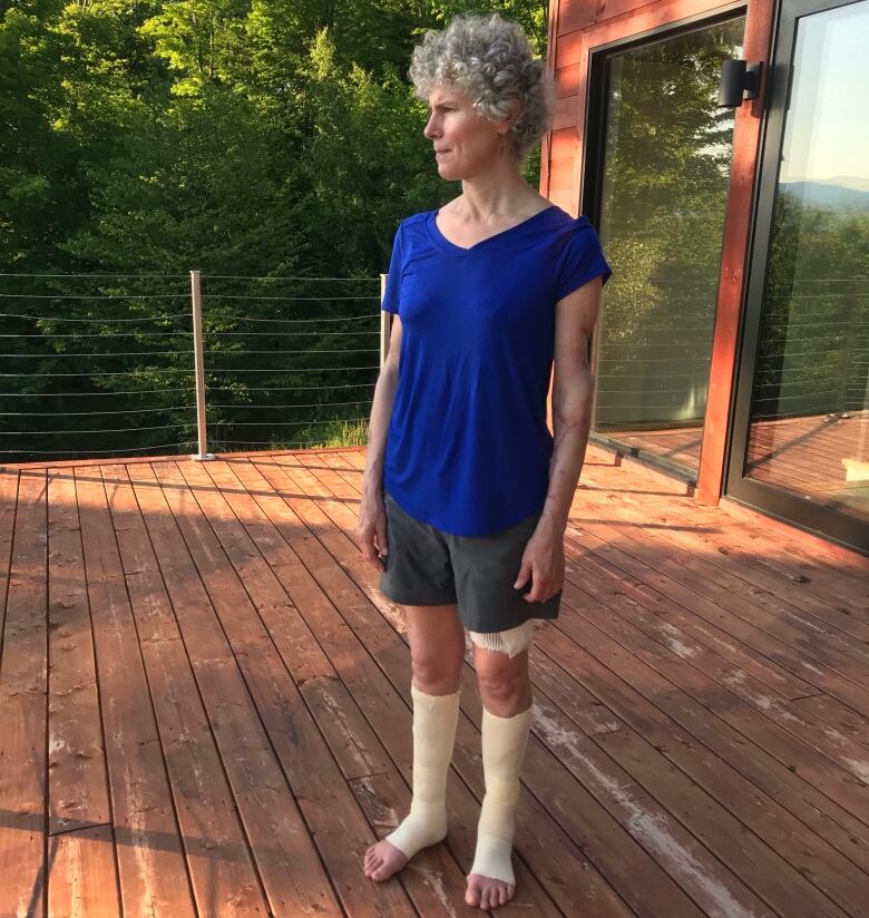 A woman stands on her porch looking away from the camera