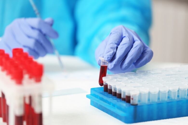 Blood vials being handled in a lab.