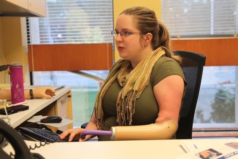 A woman with a prosthetic arm types on a computer.