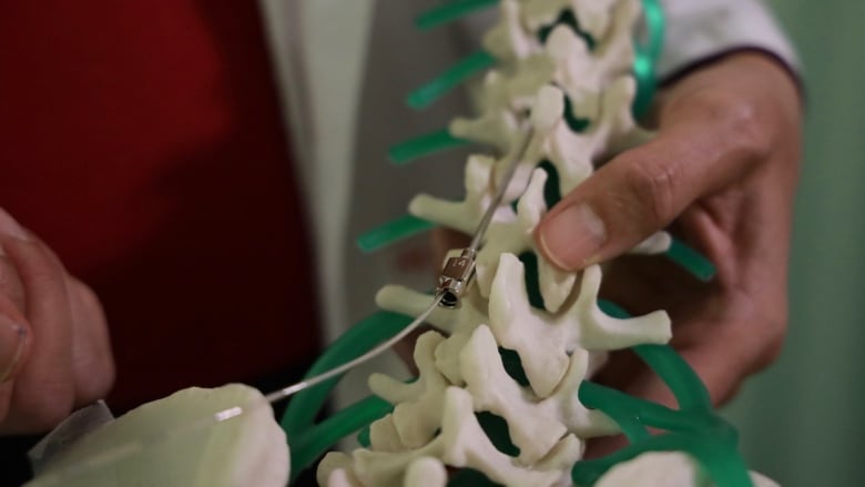 Close up of hands holding a model of a spine 