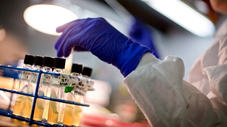 A hand in a rubber glove pulls one test tube from a tray.