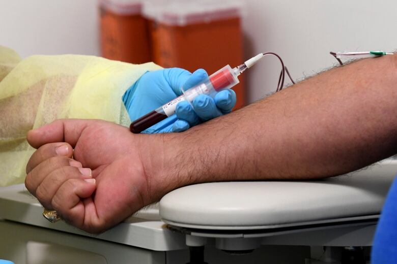 A blood sample is collected from a man's arm.