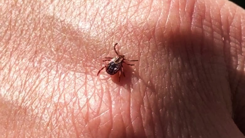 Tick on a hand.