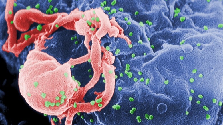 A scanning electron microscopic (SEM) image shows the presence of numerous human immunodeficiency virus-1 (HIV-1) virions budding from human cells.