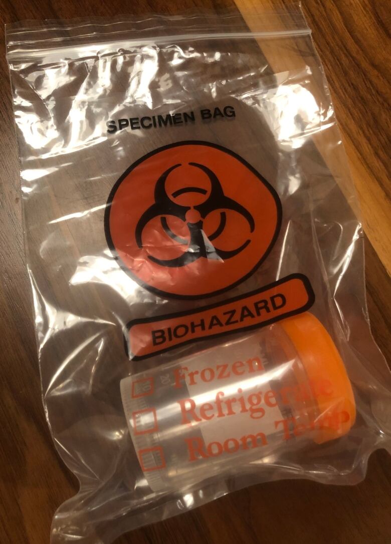 A semen sample cup within a plastic bag, that has biohazard printed on the front.