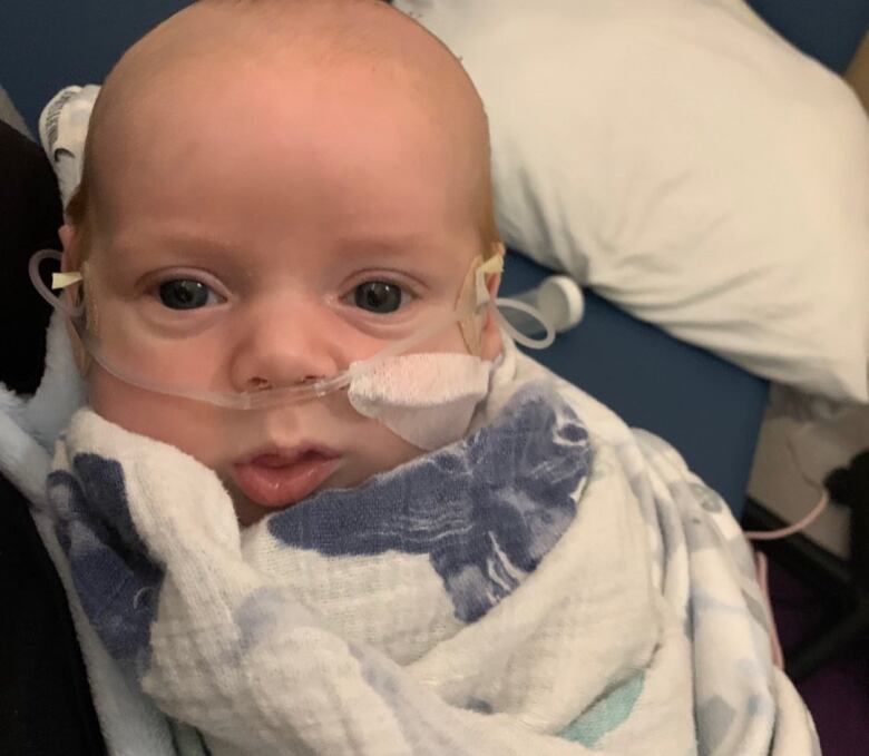 A baby lies in a hospital bed with a breathing tube in his nose.