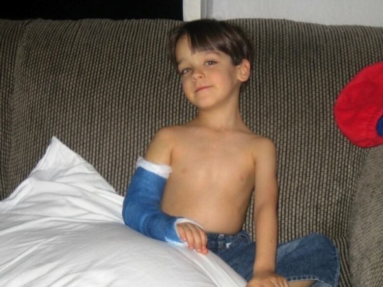 A family photo shows a small, shirtless white boy with brown hair and a blue cast on his right arm. He's sitting on a couch in blue jeans, with his injured arm resting on a white pillow.