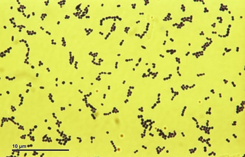 Spots of streptococcus bacteria spread across a yellow background, as seen under a microscope.