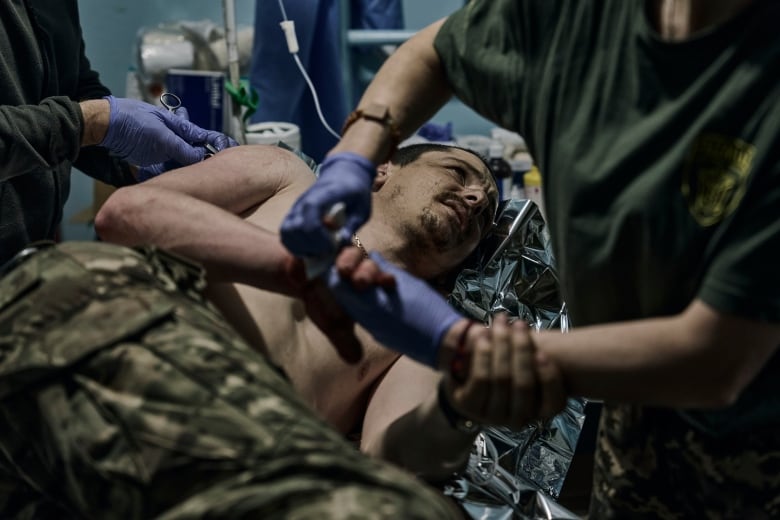 A wounded soldier lies on a hospital bed as a medical professional leans over him.