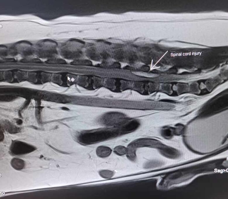 MRI showing spinal injury.