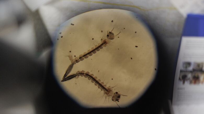 Psorophora ferox mosquito larvae are pictured under a microscope in a Peel region public health lab used as part of a West Nile Virus screening program on Aug. 1, 2023. 