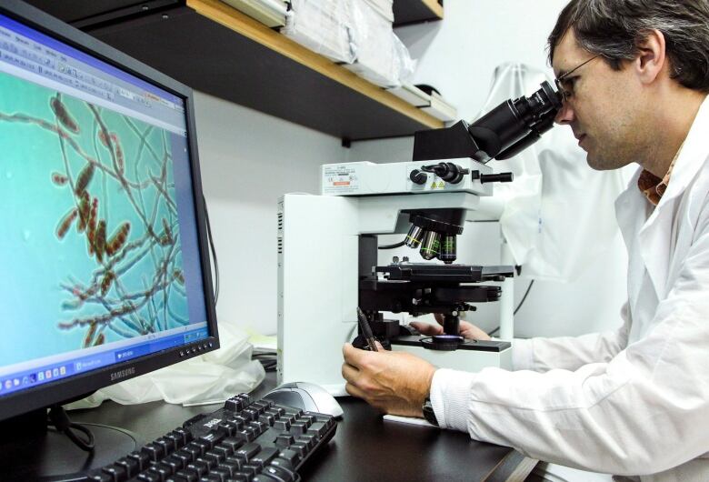 Man looking at a microscope with a projection of fungus on a screen beside him.