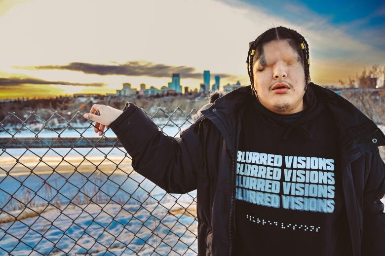 Mattmac wears a sweater with the words 'Blurred Visions' written in English and in braille.  