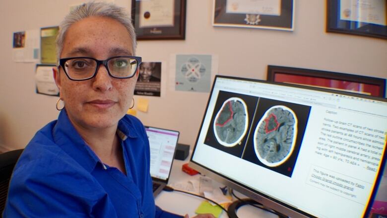 A woman in a blue shirt sits next to a computer screen with an image of a brain on it.