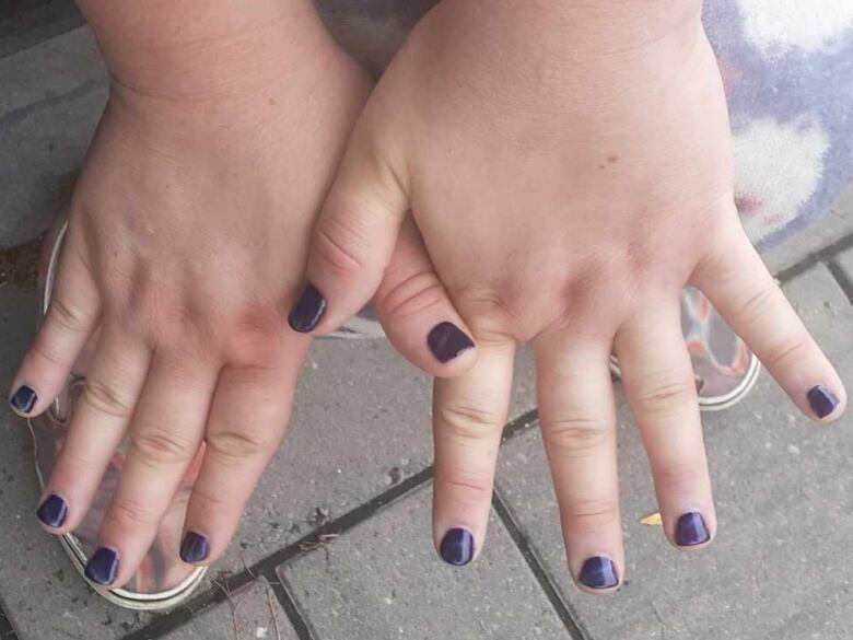 Two hands spread out show purple-painted fingernails.