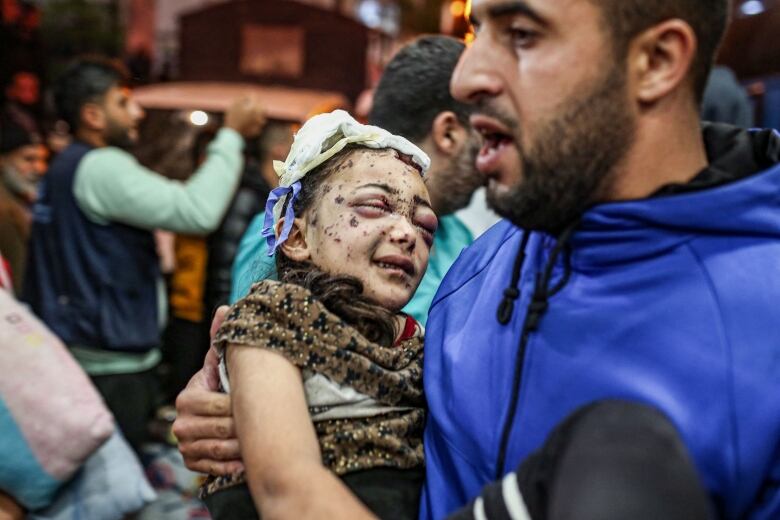 A man in blue scrubs carries a badly injured child, her eyes swollen shut and face covered in cuts. 