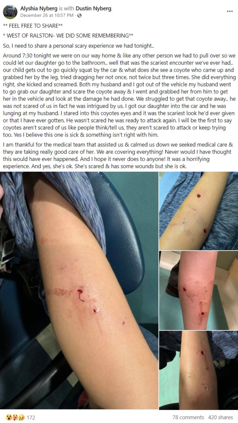 A Facebook post details the attack on a girl in southern Alberta, with graphic images of coyote bite injuries.