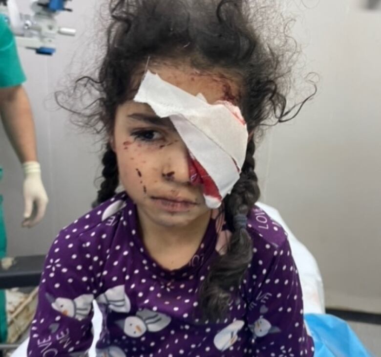 A little girl sits on a hospital bed. She is injured, with a bandage covering her eye, stained with blood.