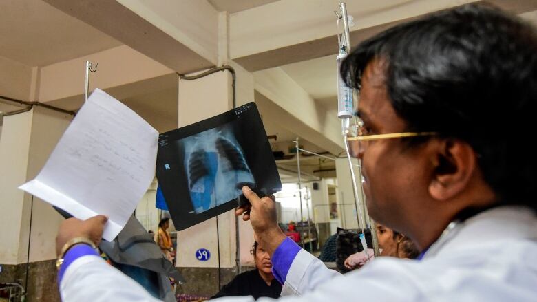 A doctor inspects the x-ray of a baby suffering from respiratory disease at a children's hospital in Dhaka, Bangladesh. 