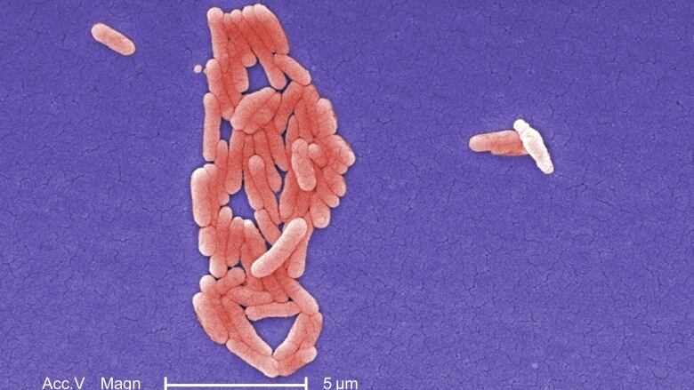 In this 2008 photograph provided by the U.S. Centers for Disease Control and Prevention (CDC), under a magnification of 5000X, this colourized scanning photomicrograph shows numbers of clustered Gram-negative Salmonella Typhimurium bacteria, the type linked to the salmonella outbreak  that resulted in the recall of more than 1,500 foods. 