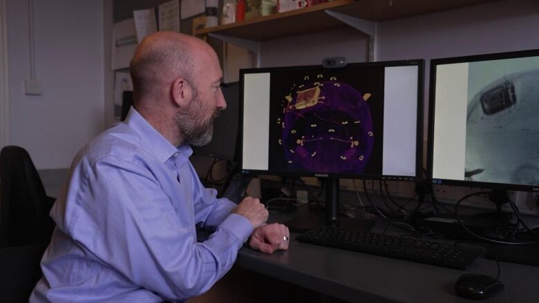 A bald man points at a computer screen showing a brain X-ray lit in purple and orange