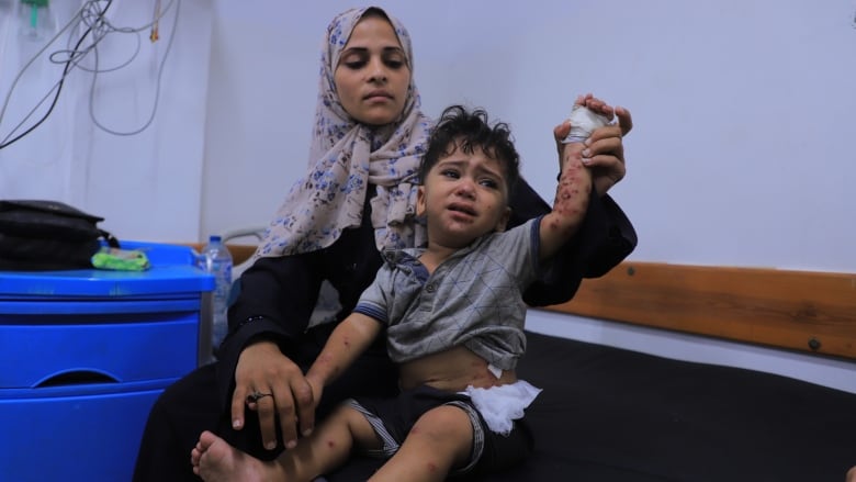 A woman in a black dress holds a toddler on her laps with his arms up and a skin rash