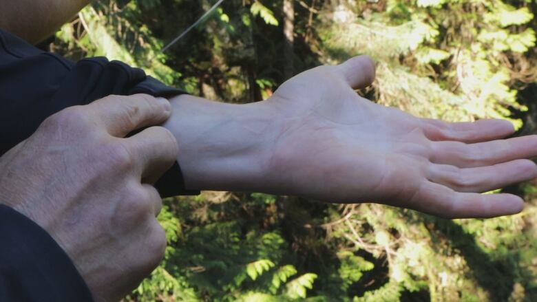 A man showing a light scar on his palm and wrist