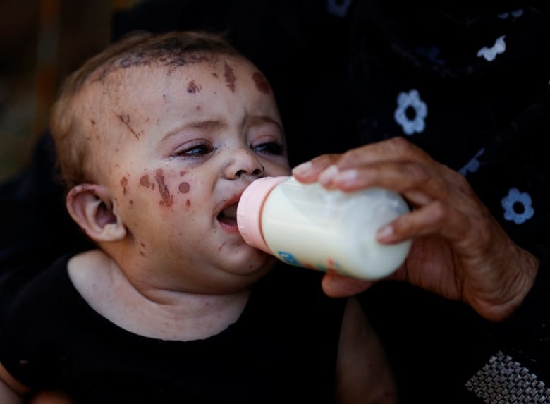 A baby cries as she is fed milk.