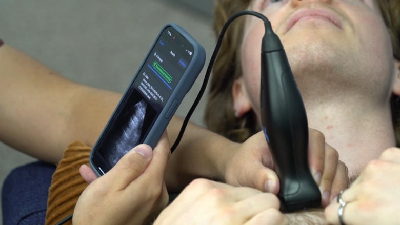 Deep Breathe's technology being used to rule out the presence of a collapsed lung.