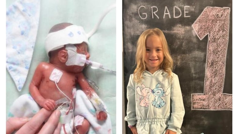 Two photos: one, a tiny premature baby hooked up to wires, and two, a little girl standing beside a chalk board with Grade 1 written on it. 