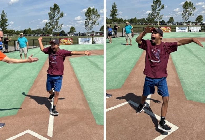 A boy with Down syndrome celebrates at a baseball game.