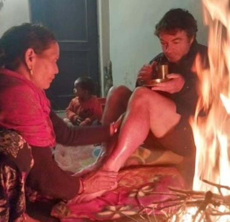 A man sits beside a fire as a woman holds his injured leg.