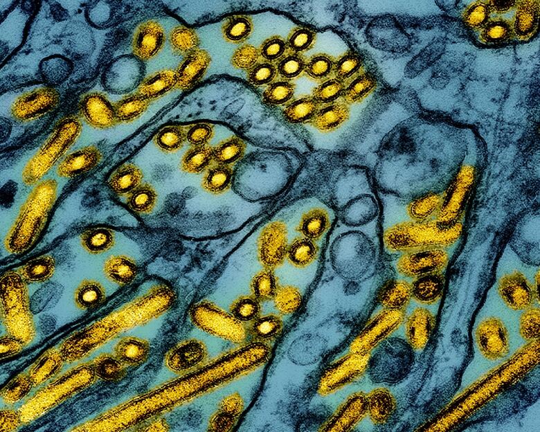 A colourized electron microscope image shows avian influenza A H5N1 virus particles (yellow), grown in canine kidney epithelial cell cultures (blue).